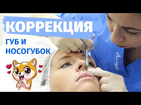 КОРРЕКЦИЯ ГУБ И НОСОГУБОК