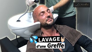 [Greffe de cheveux] Nettoyage et traitement post-opératoire chez KLINEVA  ?? ??