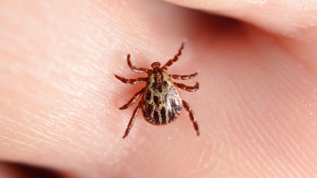 The Correct Way to Handle Tick Bites | Dr. Drew Sinatra