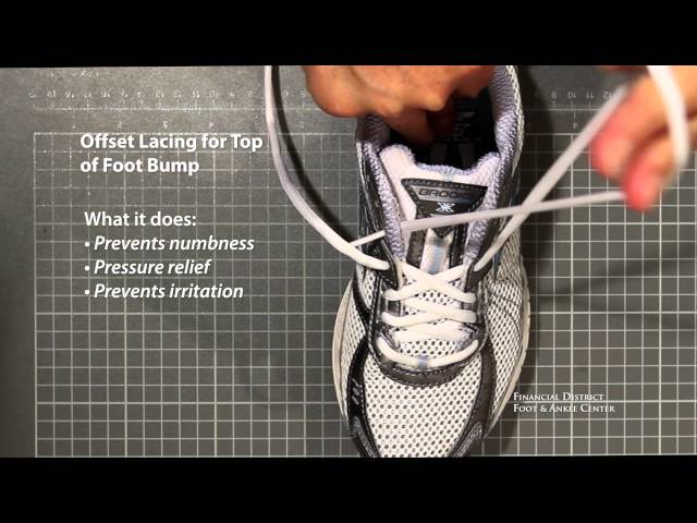 Lacing Techniques and Foot Pain - Peak Podiatry