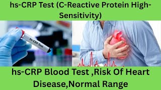 hs-CRP (High-Sensitivity C-reactive Protein) Blood Test. Normal values causes of high  hs-Crp