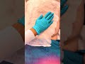 ❄️ Say goodbye to stubborn fat — without surgery!