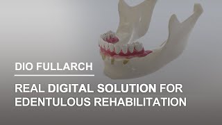DIOnavi. FullArch. A digital solution for rehabilitation of edentulous patient