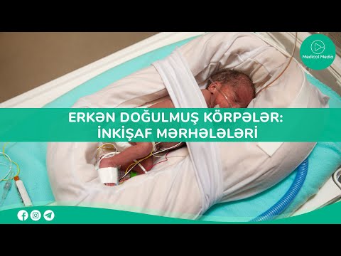 Video: Şüşə ilə qidalanan körpənin dolduğunu necə bilirsiniz?