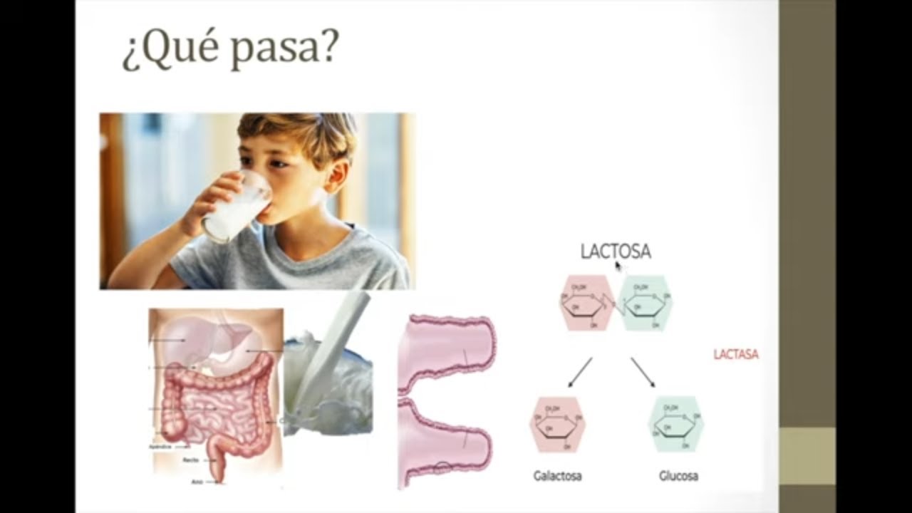 ¿Qué es la intolerancia a la lactosa?