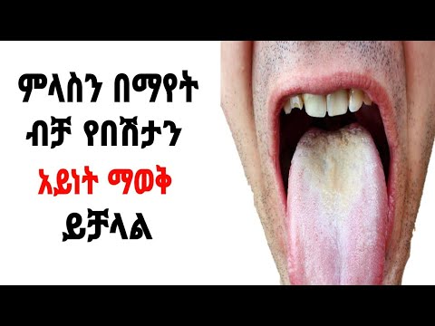 ቪዲዮ: ፍም ለምን ነጭ ይሆናል?