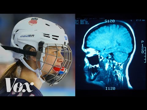 Why women’s ice hockey has a higher concussion rate than football