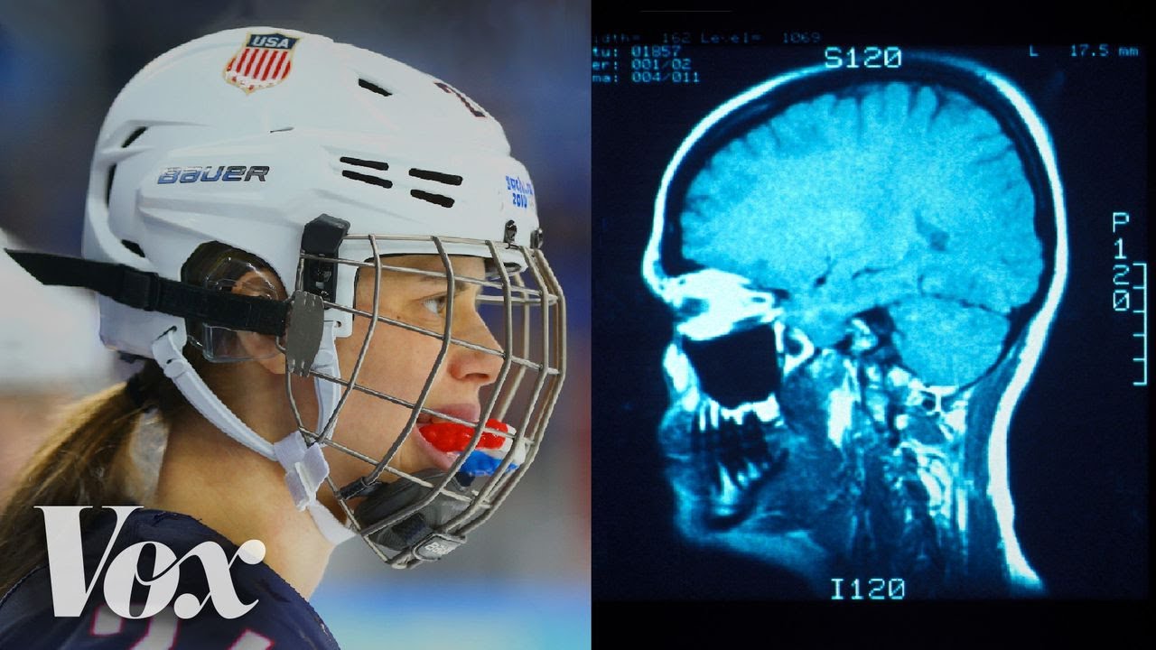 Concussions In Women's Sports