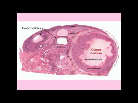 Video: Drug Treatment Of Ovarian Cysts In Women: Reviews, Drugs