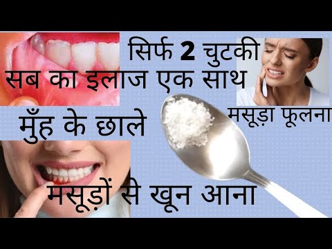 वीडियो: मसूड़े के बुलबुले को सही तरीके से कैसे उड़ाएं?