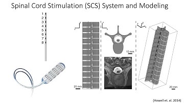 Modeling Electrical Stimulation of Neural Tissue