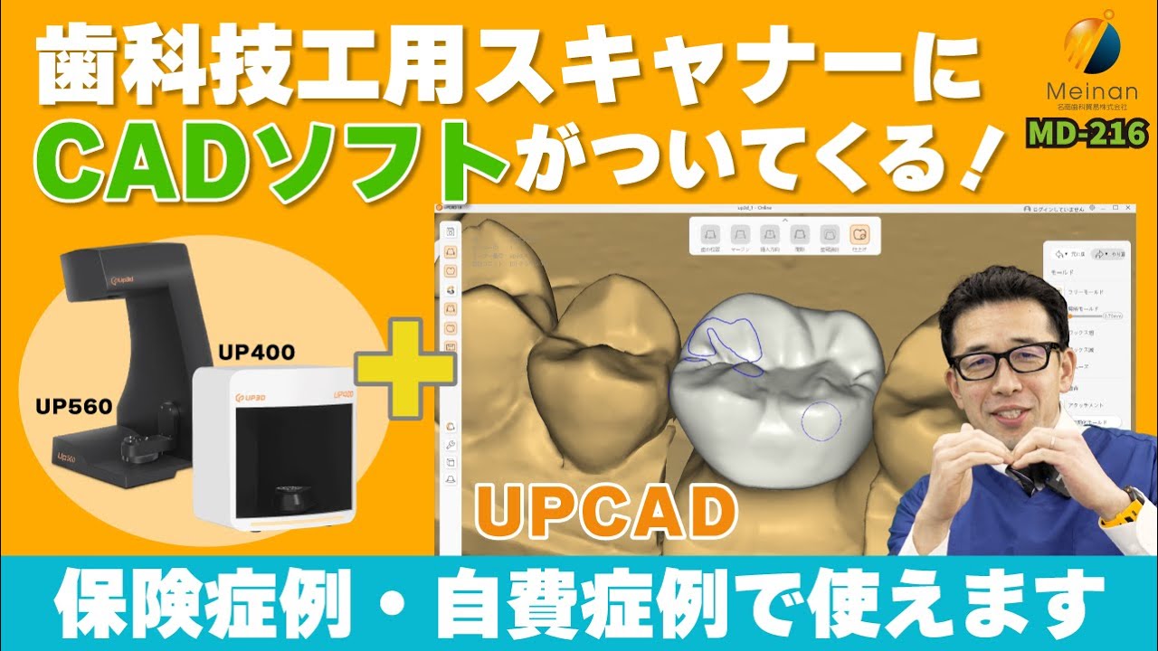 保険適用デザインOK】歯科技工用3DスキャナーとUPCADの組み合わせで 