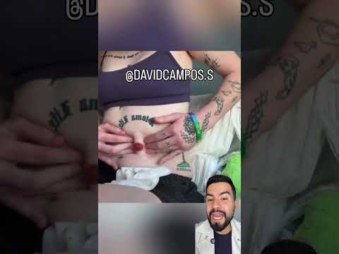 COLOSTOMÍA