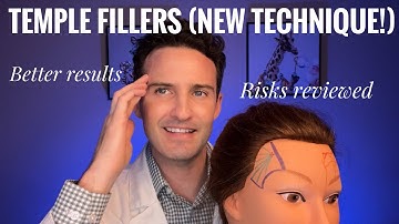 Temple Fillers 2022 (New technique!)