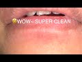 SO SATISFYING 😌 Counting &amp; Plucking Every Single Beard Hair #beardcare