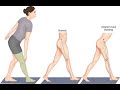 Psoatic Limp or Psoatic Gait; abnormal Walking pattern, weakness or reflex inhibition of psoas major