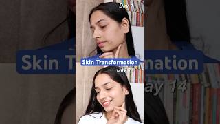Best 10% Niacinaminde Serum | Acne Marks | Dark Spots | Pilgrim #pilgrim #serum #youtubeshorts