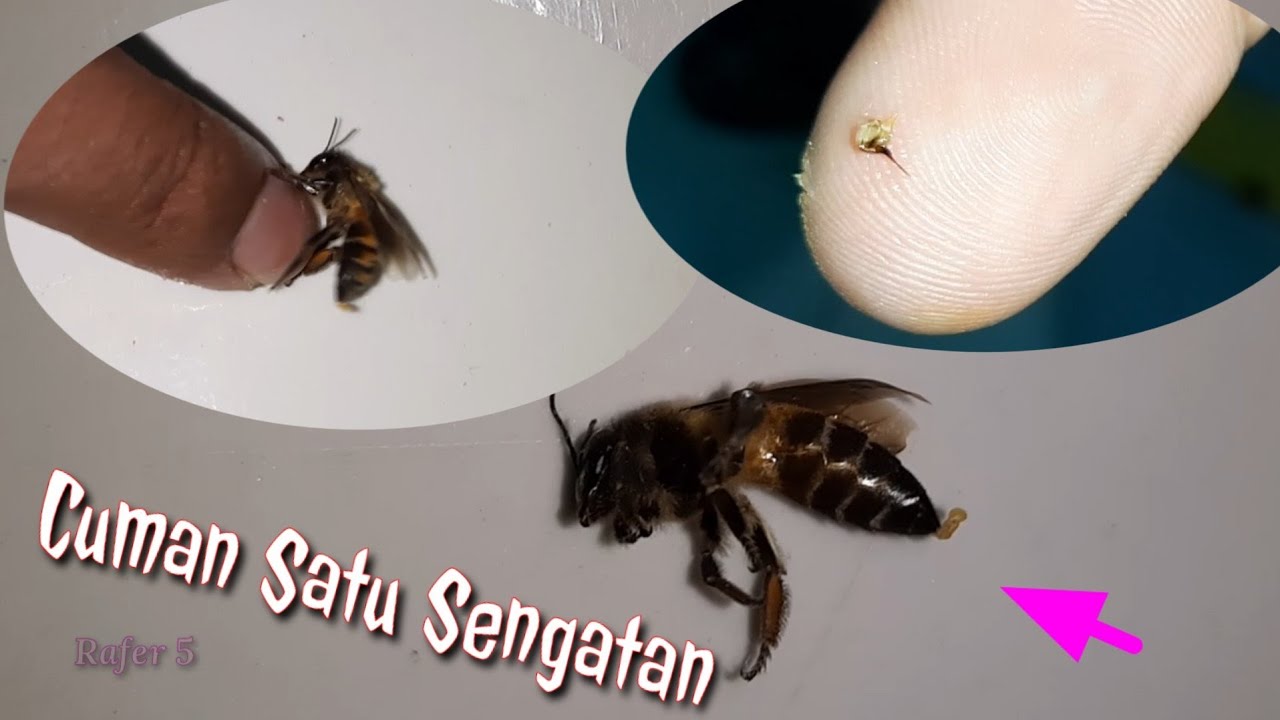 Penanganan setelah disengat lebah