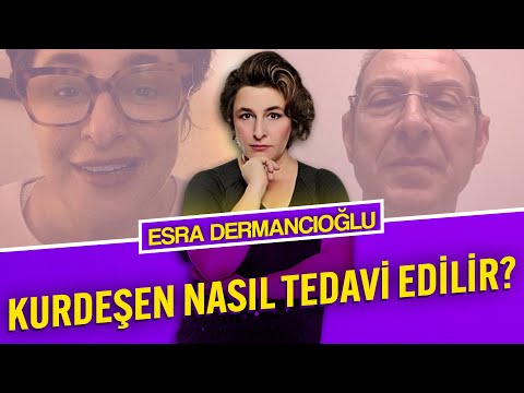 Kurdeşen Nasıl Tedavi Edilir?