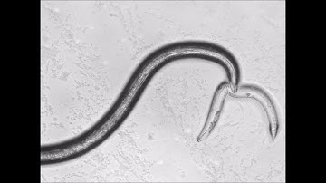 Predator Nematode : Omnivorous nematode