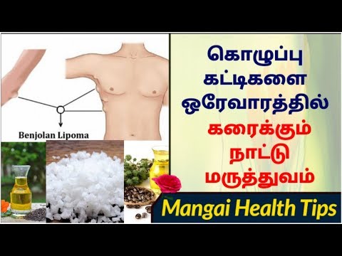 கொழுப்பு கட்டிகளை ஒரே வாரத்தில் கரைக்கும் நாட்டு மருத்துவம்| Mangai Health Tips | மங்கை | Mangai |