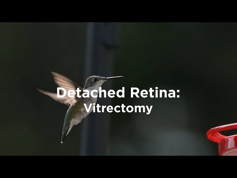 Detached Retina: Vitrectomy