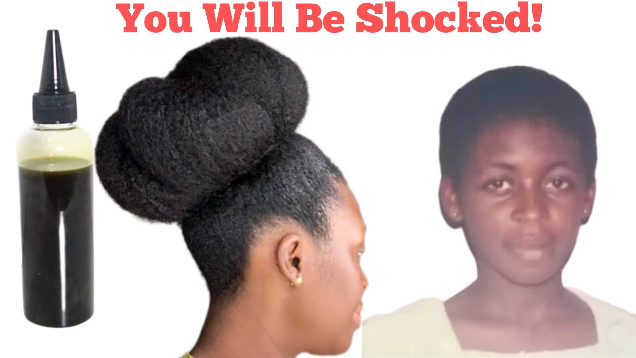 Visible Results in 7 days! Use this everyday for Massive Hair Growth & Thick Hair