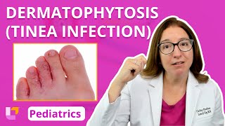 Dermatophytosis (Tinea Infection): Integumentary System - Pediatric Nursing | @LevelUpRN