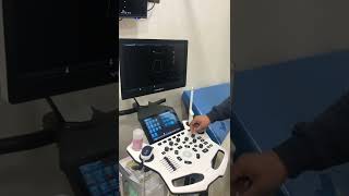 Vinno شرح سونار