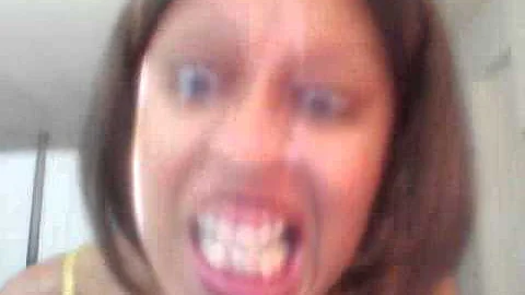 Cervical Dystonia funny video