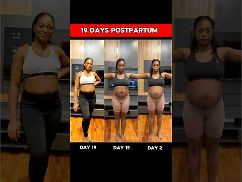 Best Diastasis Recti Results. No Gym No Equipment Needed #food #fitnessmotivation #postpartum