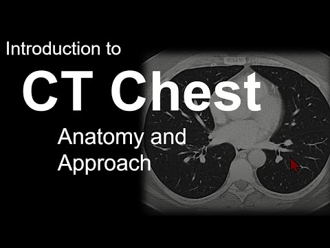 Video: Ce este numărul CT reticulat?