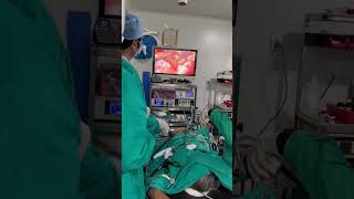 Laparoscopic ovarian cyst removal. 2 liter cystic fluid removed #shorts #surgery
