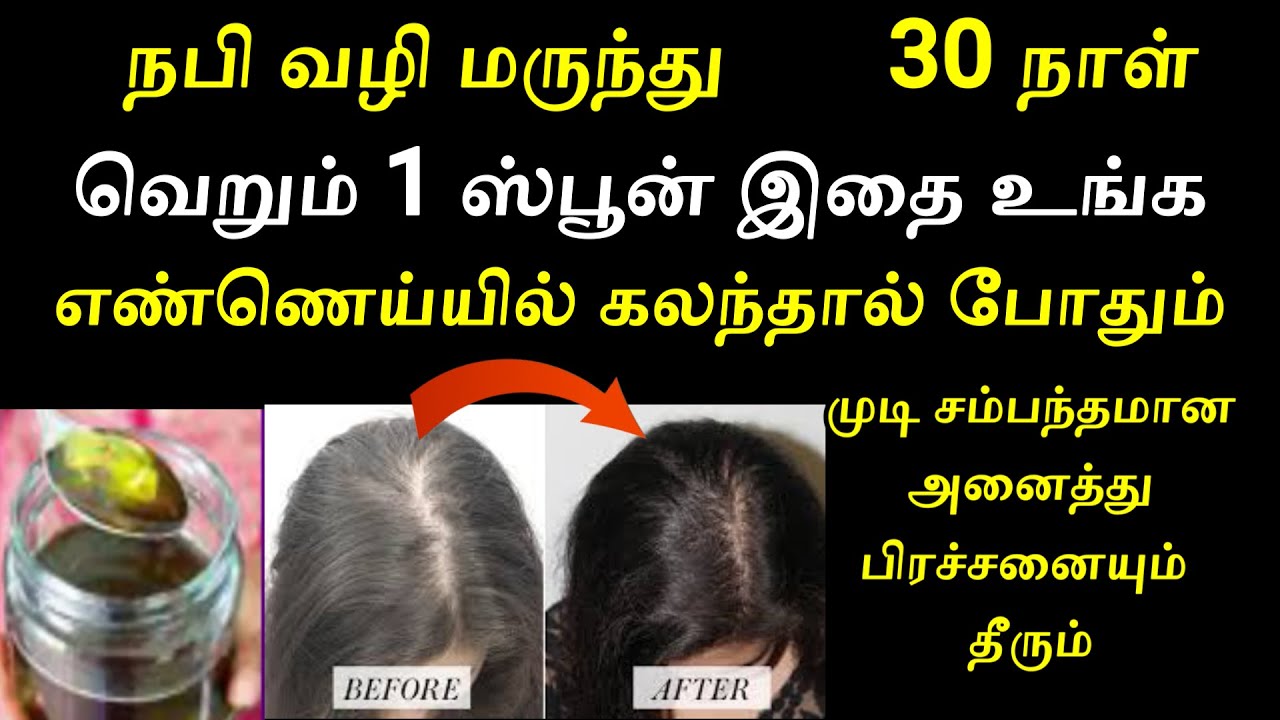 நபி வழி முடி உதிர்வு தீர்வு