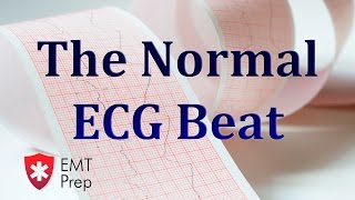 The Normal ECG Beat - EMTprep.com