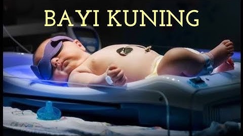 Jangan PANIK !! Ini Cara Mengatasi Bayi Kuning