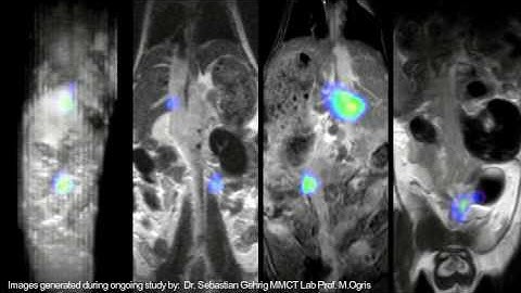 Aspect Imaging Enhancing 3D Optical Tomography through Compact MRI