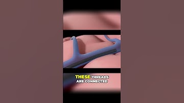 Connecting the HUMAN BRAIN to Computers  Exploring the Future of Neuralink Technology