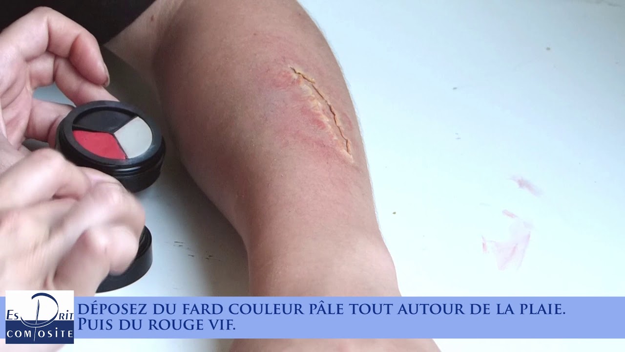 plaie a vif plaie a vif