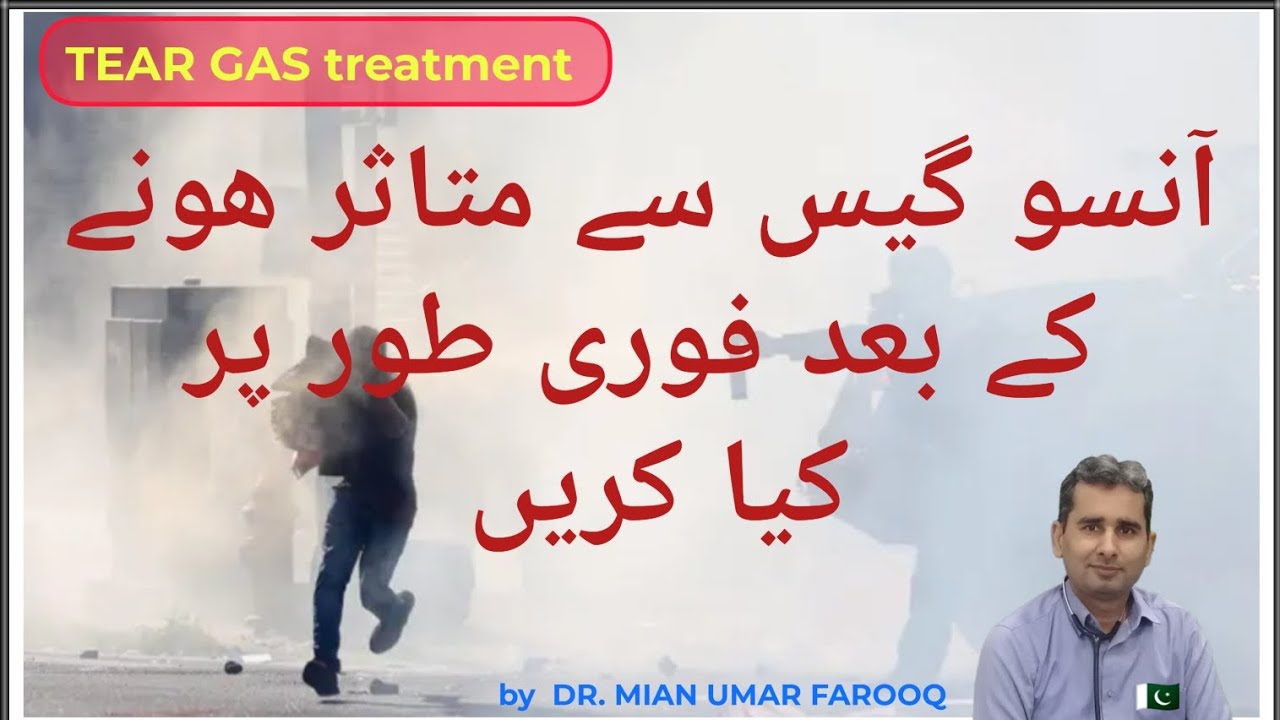 Tear Gas Treatment What Is Tear Gas tear-gas-treatment-what-is-tear-gas