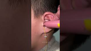 This Process Creates An Exact Copy Of Your Ear