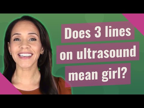 Video: Vai 3 rindiņas ultraskaņā var nozīmēt zēnu?