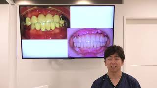 イクメンデンティストが語るインプラント治療を成功させるための歯科医院選び