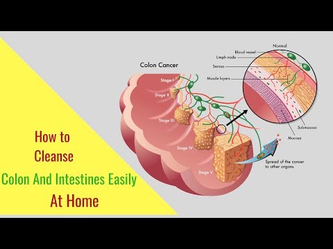 how-to-cleanse-colon-and-intestines-easily-at-home