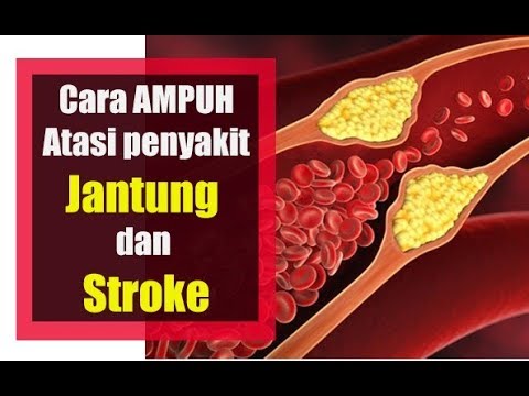 Video: Ilmuwan Telah Menyelidiki Efek Meditasi Pada Kesehatan Jantung - Pandangan Alternatif