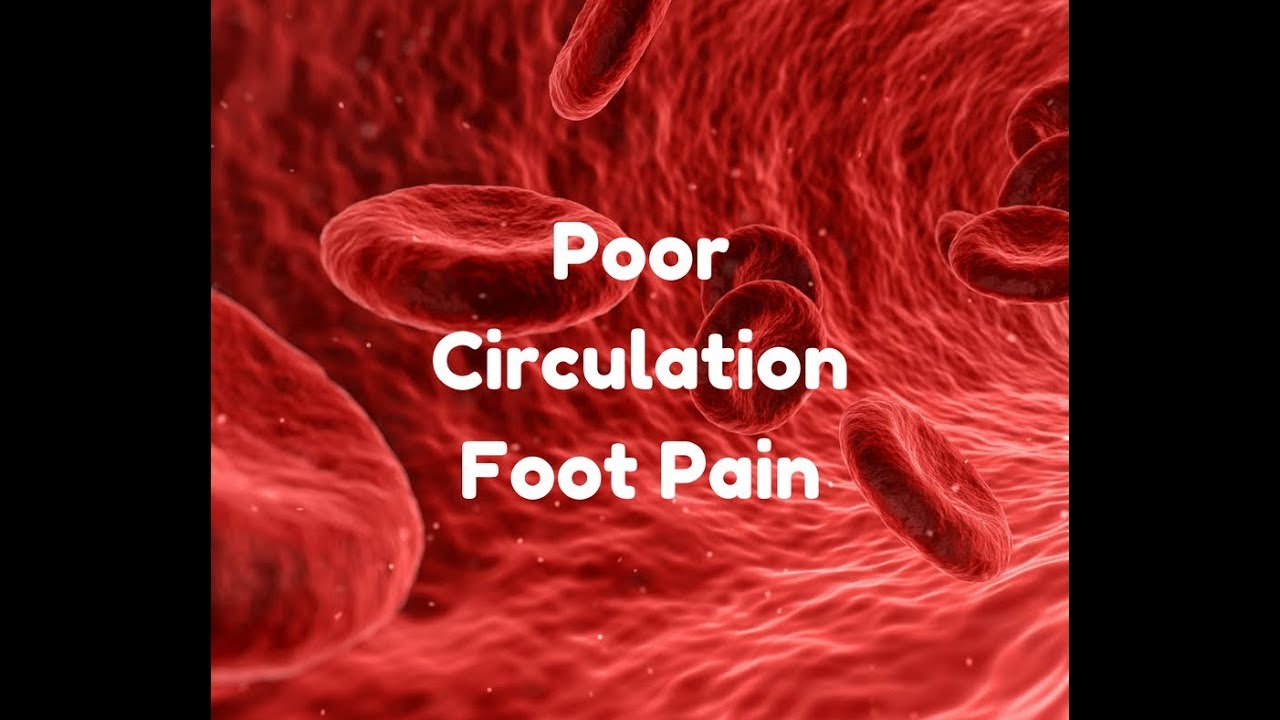 Poor Circulation Foot Pain YouTube Poor Circulation Foot Pain YouTube