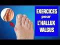 HALLUX VALGUS : TRAITEMENT ET EXERCICES KINÉ