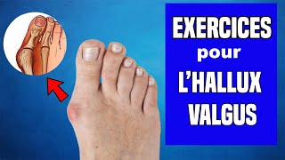 HALLUX VALGUS : TRAITEMENT ET EXERCICES KINÉ