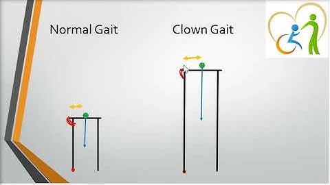 Gait Assessment Practice video