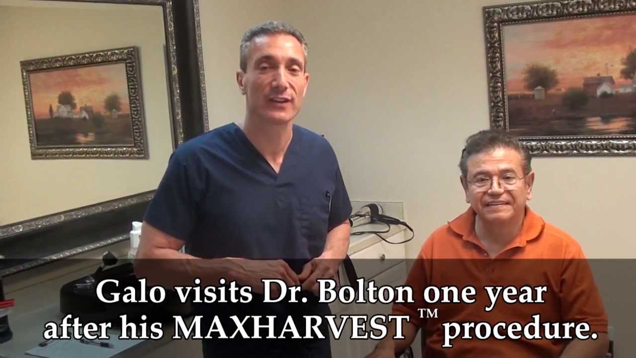 Check Out This Amazing Corrective Hair Transplant Procedure Result